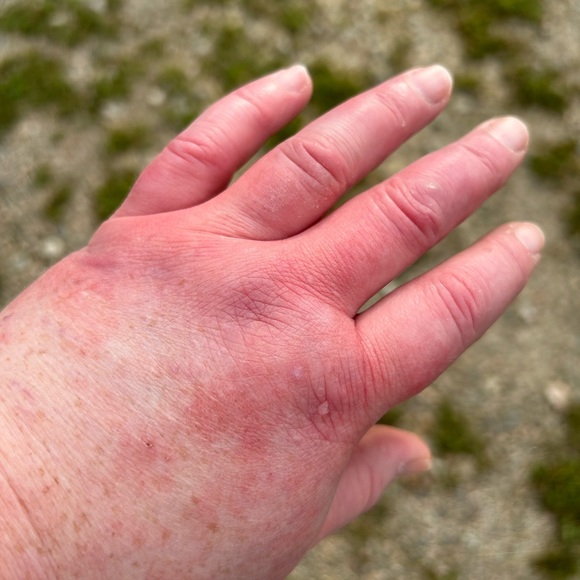 Your purchases help me while i try to get disability for a rare brain disease - Picture 8 of 10